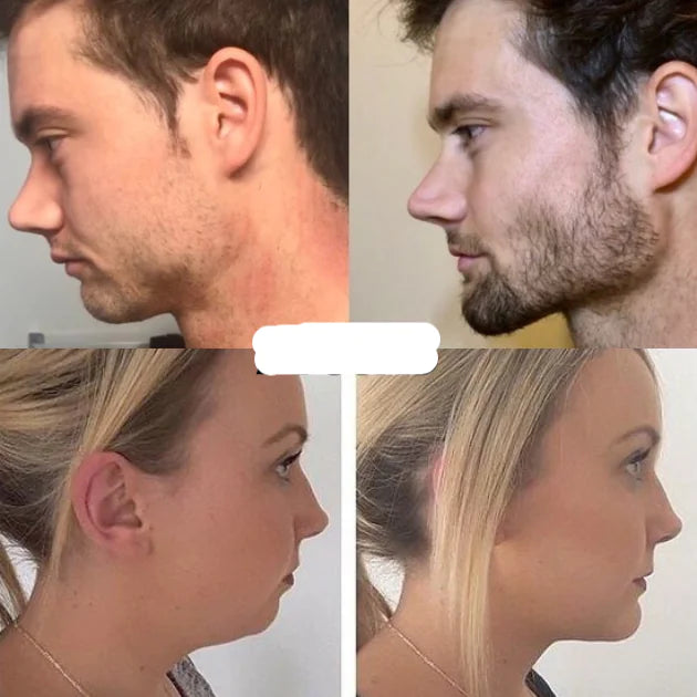 BluTFul Definition Trainer™ – Jawline Resistance Tool