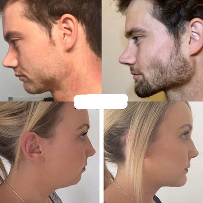 BluTFul Definition Trainer™ – Jawline Resistance Tool